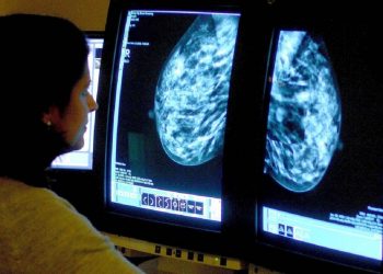 mammogram for breast cancer