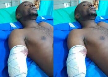 Animal Feed Company Factory Machine Cuts Off Worker’s Hand In Ogun