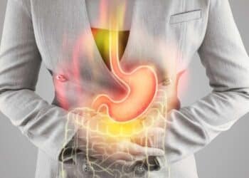 Stomach ulcers gastric ulcers ulcer